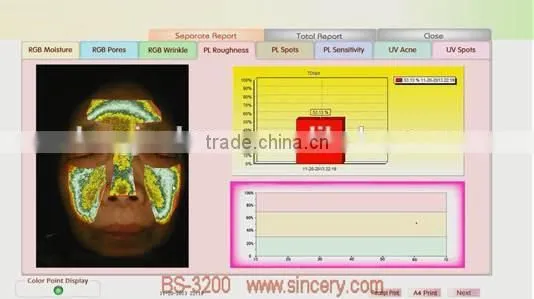 Portable Facial Skin Scanner Analyzer 3D Facial Skin Analysis photo-4