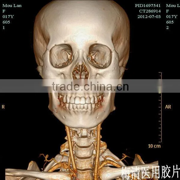 Medical Dry Film for Hospital