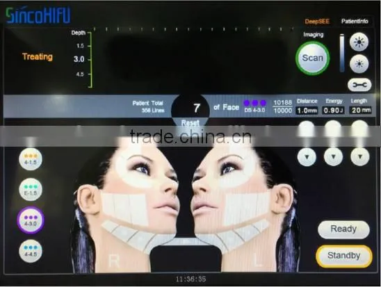 Expression Lines Removal Factory Sell USA 0.2-3.0J Hifu Face Lift Machine photo-4