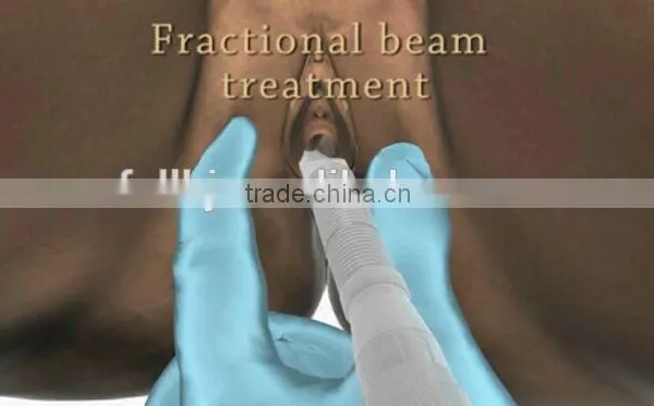 Tumour Removal Factory Price Vaginal Tightening Fractional Co2 Laser / Medical Portable Warts Removal Fractional Laser Co2 Vaginal Tightening Machine Acne Scar Removal photo-2