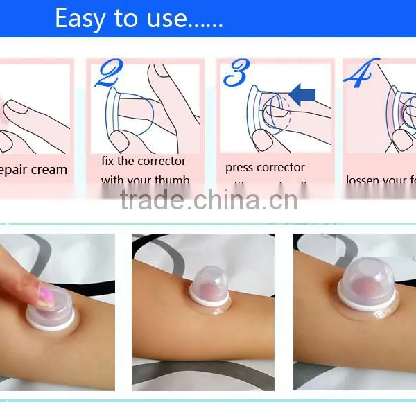 Imported High Medical Grade Silicone Nipple Correction Cups Breast Enlarger Nipple Corrector for Inverted or Flat Nipples photo-6