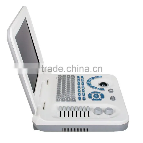 Portable Laptop Ultrasound Scanner With CE photo-3