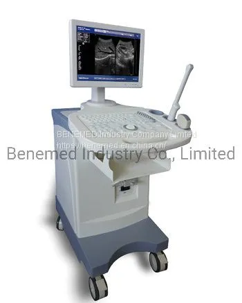 Trolly Build-in Black and White Ultrasound Scanner Diagnostic Equipment photo-2