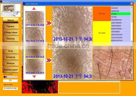 AYJ-J019 Facial Skin Moisture Monit Analyzer/digital Skin Analyzer photo-4