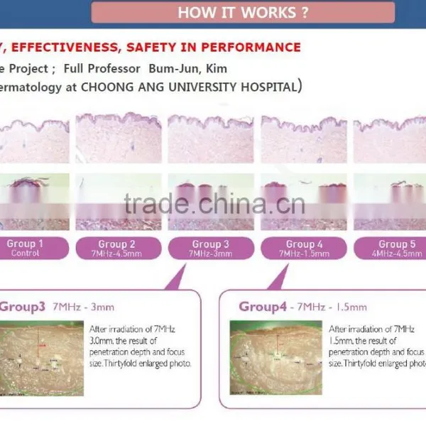 Waist Shaping Portable HIFU Beauty Machine /China HIFU Factory In 5.0-25mm Quality HIFU Technology Deepth 4.5MM Dermis Effective HIFU Results 0.2-3.0J photo-2