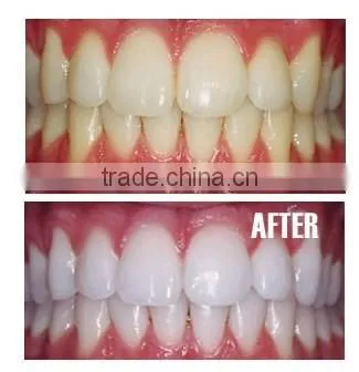 Teeth Whitening Tooth Whitener Gel Pen photo-3