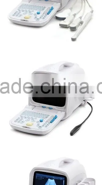 Lowe Price Medical Equipment Portable Cheap Ultrasound Scanner/Machine 3.5Mhz Multi-frequency Convex Probe photo-2