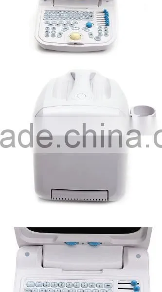 Lowe Price Medical Equipment Portable Cheap Ultrasound Scanner/Machine 3.5Mhz Multi-frequency Convex Probe photo-4