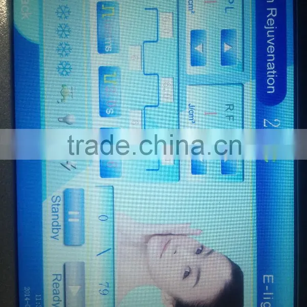 Hot Selling!! Factory Price,ce Approval Portable Shr Elight Machine for Fast Hair Removal photo-4