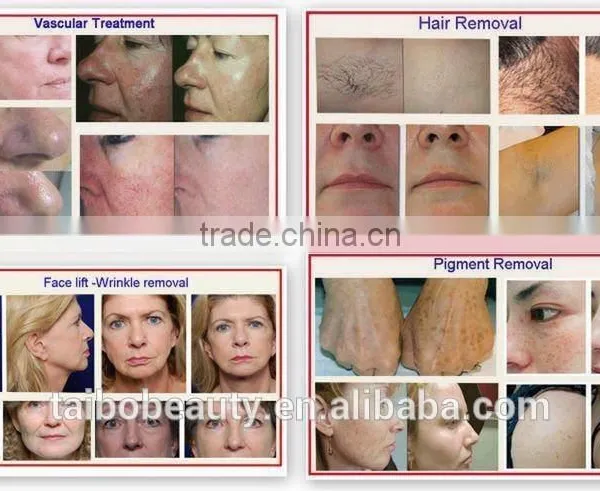 China Made Professional Portable Ipl Hair Removal Machine With CE Certification for Clinic and Beauty Spa photo-4