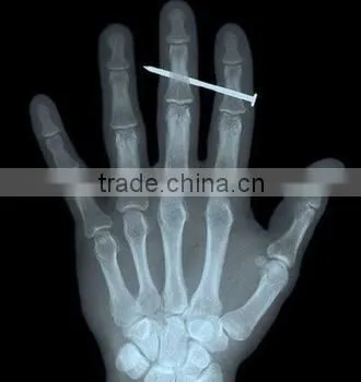 Medical X-ray Film Agfa Medical Dry Film for X-ray Machine Agfa Kodak Film photo-3
