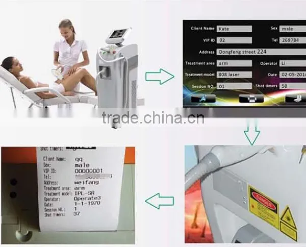 2016 Hot Stationary 808nm Diode Laser Medical Hair Removal/laser Diode Leg Hair Removal photo-4
