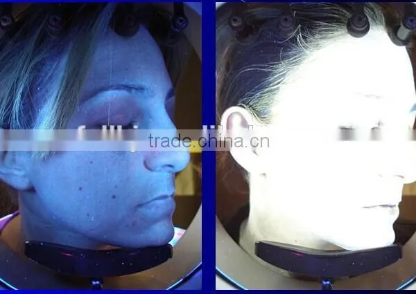 3D Intelligent Skin Analyzer Machine Best Selling Skin Analyzing Equipment photo-3